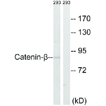 Anti-Catenin-β antibody produced in rabbit，100UG，SAB4500545-100UG，Sigma