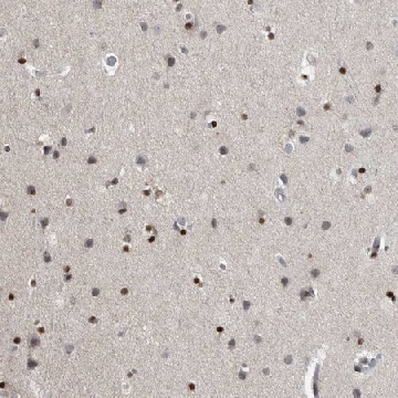 Anti-EVI5 antibody produced in rabbit，100UL，HPA027339-100UL，Sigma