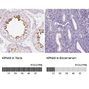 Anti-KPNA5 antibody produced in rabbit，100UL，HPA054037-100UL，Sigma