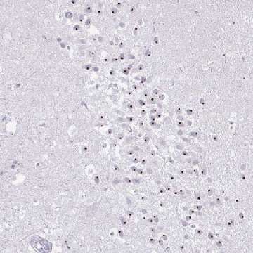 Anti-FAM9A antibody produced in rabbit，100UL，HPA056076-100UL，Sigma