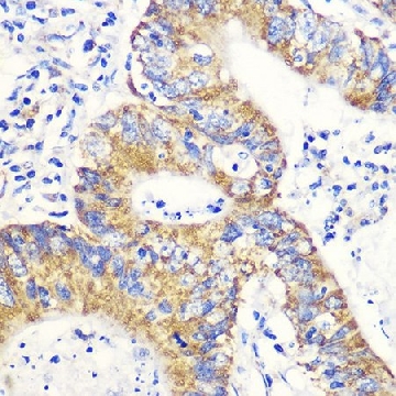 抗-兔产生的NRF2抗体，100UL，SAB5700720-100UL，Sigma