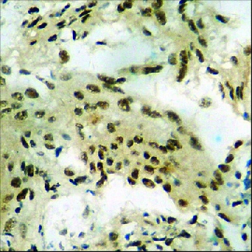 Anti-phospho-GR (pSer²⁰³) antibody produced in rabbit，100UG，SAB4504585-100UG，Sigma