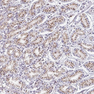 Anti-ZNF526 antibody produced in rabbit，100UL，HPA023070-100UL，Sigma