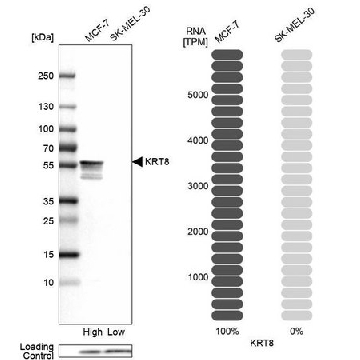 Anti-KRT8 antibody produced in rabbit，100UL，HPA049866-100UL，Sigma