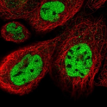 Anti-CCNDBP1 antibody produced in rabbit，100UL，HPA041065-100UL，Sigma