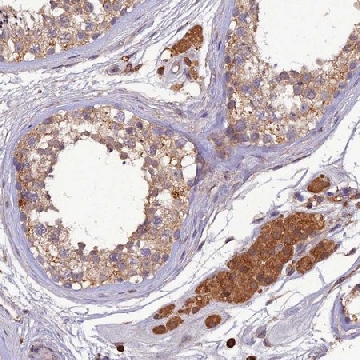 Anti-TMEM258 antibody produced in rabbit，100UL，HPA044602-100UL，Sigma