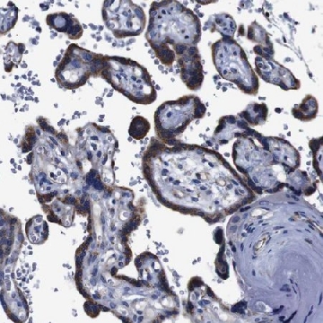 Anti-FKBP9 antibody produced in rabbit，100UL，HPA012595-100UL，Sigma