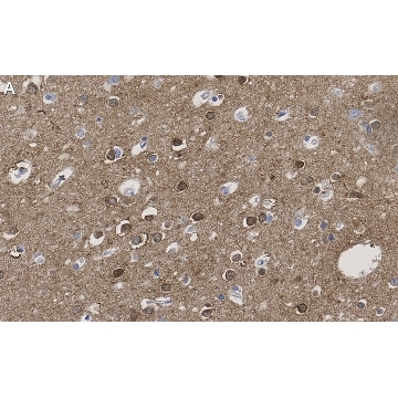 Anti-CRBN Antibody, clone 3I23 ZooMAb® Rabbit Monoclonal，25UL，ZRB1304-25UL，Sigma
