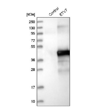 Anti-ETV7 antibody produced in rabbit，100UL，HPA029033-100UL，Sigma