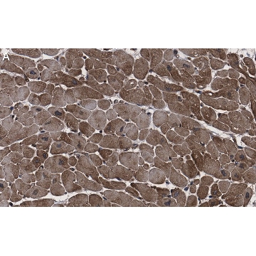 Anti-CACNA1C Antibody, clone 1F20 ZooMAb® Rabbit Monoclonal，25UL，ZRB1293-25UL，Sigma