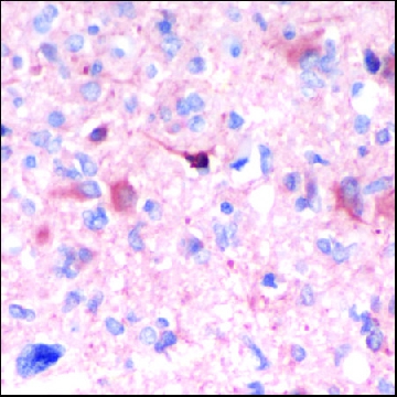 Anti-GFAP antibody, Rabbit monoclonal，100UL，SAB5500113-100UL，Sigma