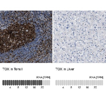Anti-TOX antibody produced in rabbit，100UL，HPA018322-100UL，Sigma