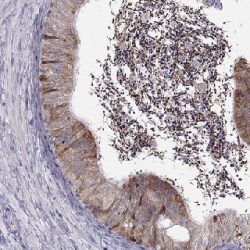 Anti-ROPN1B antibody produced in rabbit，100UL，HPA052530-100UL，Sigma
