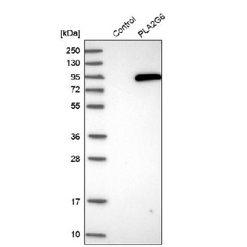 Anti-PLA2G6 antibody produced in rabbit，100UL，HPA001171-100UL，Sigma
