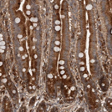 Anti-RNF207 antibody produced in rabbit，100UL，HPA028378-100UL，Sigma