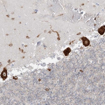 Anti-FARSB antibody produced in rabbit，100UL，HPA036677-100UL，Sigma