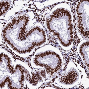 Anti-SRRM2 antibody produced in rabbit，100UL，HPA041411-100UL，Sigma