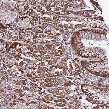 Anti-AMER3 antibody produced in rabbit，100UL，HPA045593-100UL，Sigma