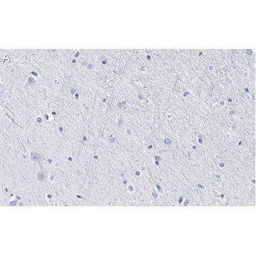 Anti-BLBP/FABP7 Antibody, clone 7I23, ZooMAb® Rabbit Monoclonal，25UL，ZRB13190-25UL，Sigma