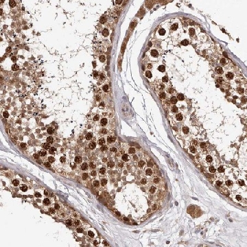 Anti-RNF187 antibody produced in rabbit，100UL，HPA030098-100UL，Sigma