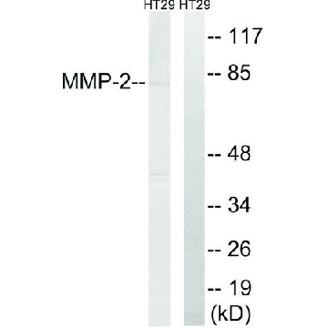 Anti-MMP-2 antibody produced in rabbit，100UG，SAB4501891-100UG，Sigma