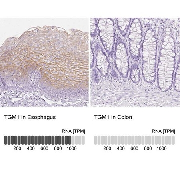 Anti-TGM1 antibody produced in rabbit，100UL，HPA040171-100UL，Sigma
