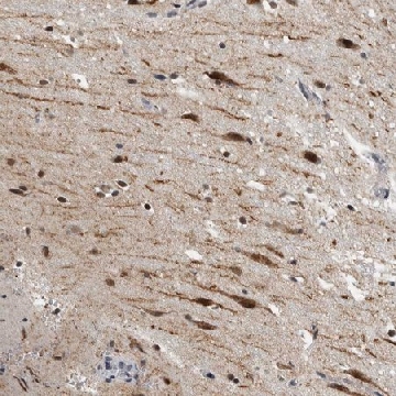Anti-ZMYND8 antibody produced in rabbit，100UL，HPA020949-100UL，Sigma