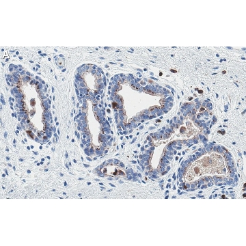 Anti-PTEN Antibody, clone 6B12 ZooMAb® Rabbit Monoclonal，4X25UL，ZRB1504-4X25UL，Sigma