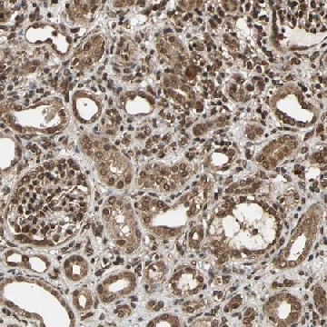 Anti-USP42 antibody produced in rabbit，100UL，HPA006752-100UL，Sigma