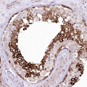 Anti-YBX3 antibody produced in rabbit，100UL，HPA034838-100UL，Sigma