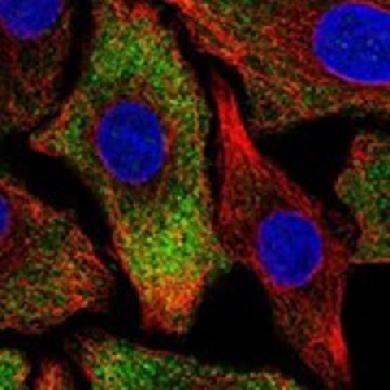 Anti-PNPLA6 antibody produced in rabbit，100UL，HPA064773-100UL，Sigma