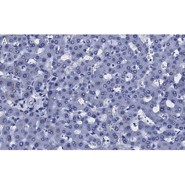 Anti-Transferrin Antibody, clone 2B8 , ZooMAb® Rabbit Monoclonal，4X25UL，ZRB1225-4X25UL，Sigma