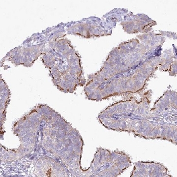 Anti-CEP164 antibody produced in rabbit，100UL，HPA037606-100UL，Sigma