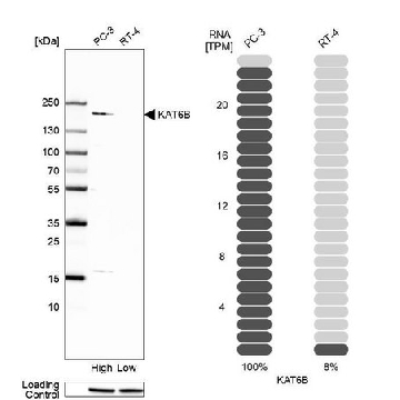 Anti-KAT6B antibody produced in rabbit，100UL，HPA006104-100UL，Sigma