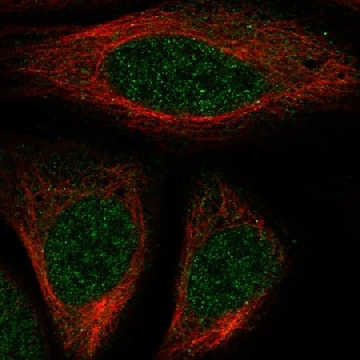 Anti-HOXA7 antibody produced in rabbit，100UL，HPA074048-100UL，Sigma