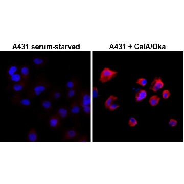 Anti-Phosphothreonine antibody, Rabbit monoclonal，100UG，SAB5600203-100UG，Sigma