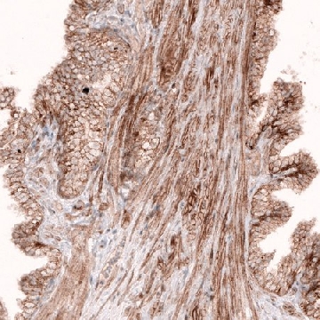 Monoclonal Anti-ROR2 antibody produced in mouse，100UL，AMAB91402-100UL，Sigma