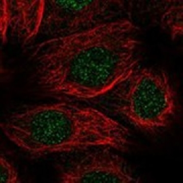 Anti-ALKBH1 antibody produced in rabbit，100UL，HPA060061-100UL，Sigma