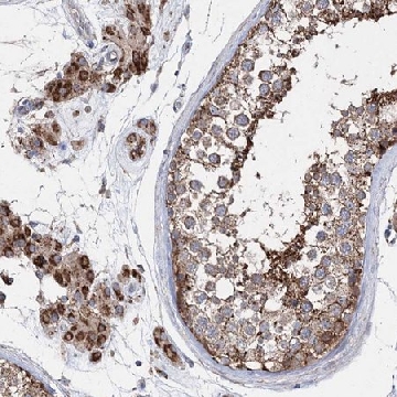 Anti-NGLY1 antibody produced in rabbit，100UL，HPA036825-100UL，Sigma