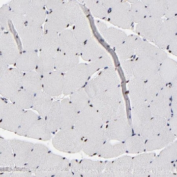 Anti-OGFOD1 antibody produced in rabbit，100UL，HPA003215-100UL，Sigma