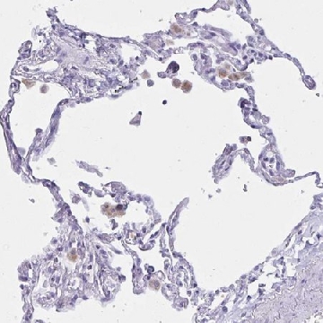 Anti-XCL1 antibody produced in rabbit，100UL，HPA057725-100UL，Sigma
