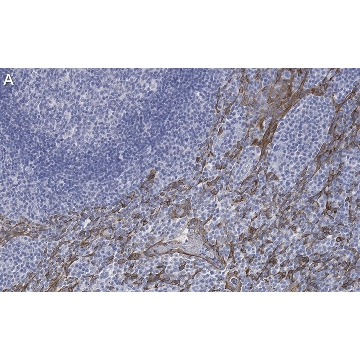 Anti-Cytokeratin 5/6 Antibody, clone D5/16 B4 ZooMAb® Mouse Monoclonal，25UL，ZMS1057-25UL，Sigma