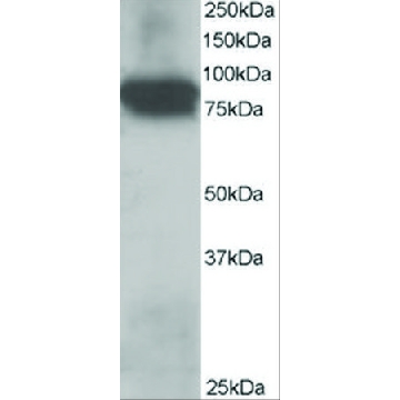 Anti-Plakoglobin/γ-Catenin antibody produced in goat，100UG，SAB2500802-100UG，Sigma