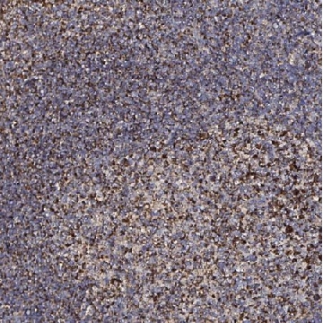 Anti-ATAD3B antibody produced in rabbit，100UL，HPA058968-100UL，Sigma