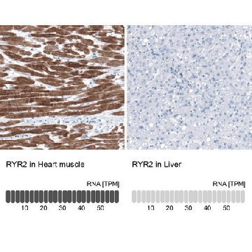 Anti-RYR2 antibody produced in rabbit，100UL，HPA020028-100UL，Sigma