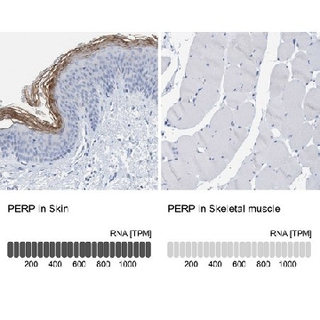 Anti-PERP antibody produced in rabbit，100UL，HPA022269-100UL，Sigma