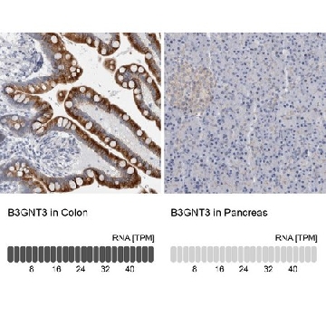 Anti-B3GNT3 antibody produced in rabbit，100UL，HPA024298-100UL，Sigma