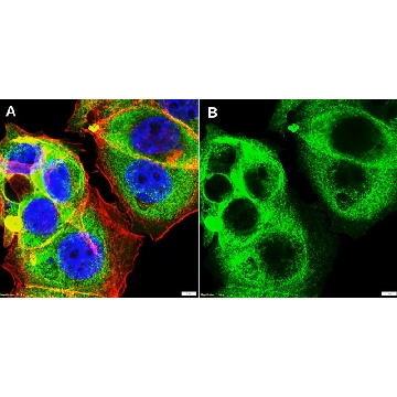 Anti-ARPC5 Antibody, clone 1H16 ZooMAb® Rabbit Monoclonal，254G，ZRB2113-25UL，Sigma