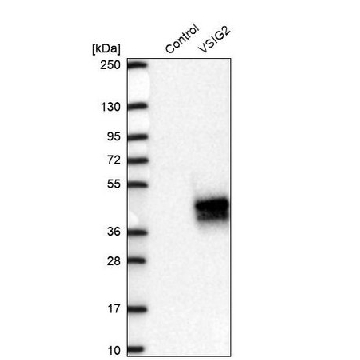 Anti-VSIG2 antibody produced in rabbit，100UL，HPA050147-100UL，Sigma