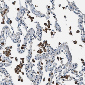 Anti-SLC19A2 antibody produced in rabbit，100UL，HPA016599-100UL，Sigma